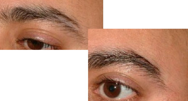 Before and after pictures of a man's eyebrows.