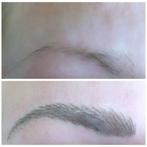 A woman's eyebrows before and after treatment.