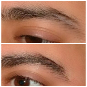 A man's eyebrows before and after treatment.