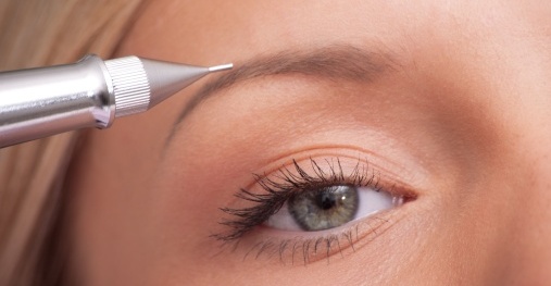 A woman is getting her eyebrows injected with a needle.