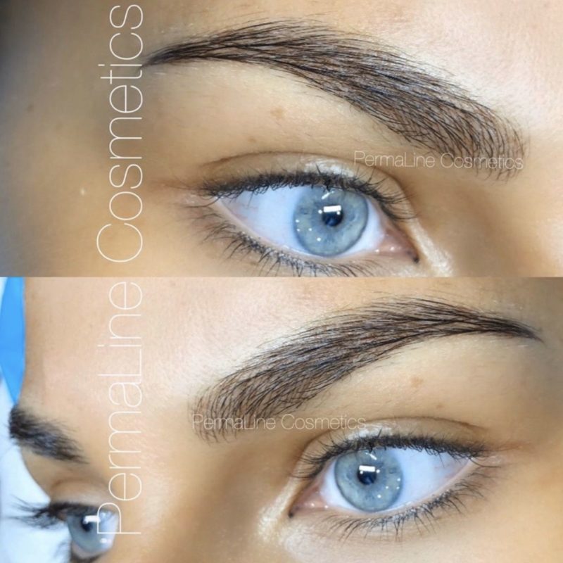 A woman's eyebrows before and after treatment.