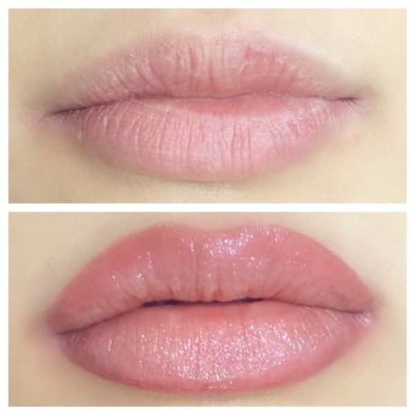 Before and after pictures of a woman's lips.
