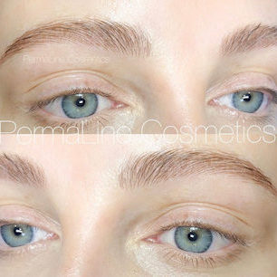 A woman's eyebrows before and after treatment.