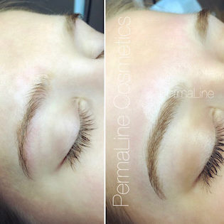 A woman's eyebrows before and after treatment.