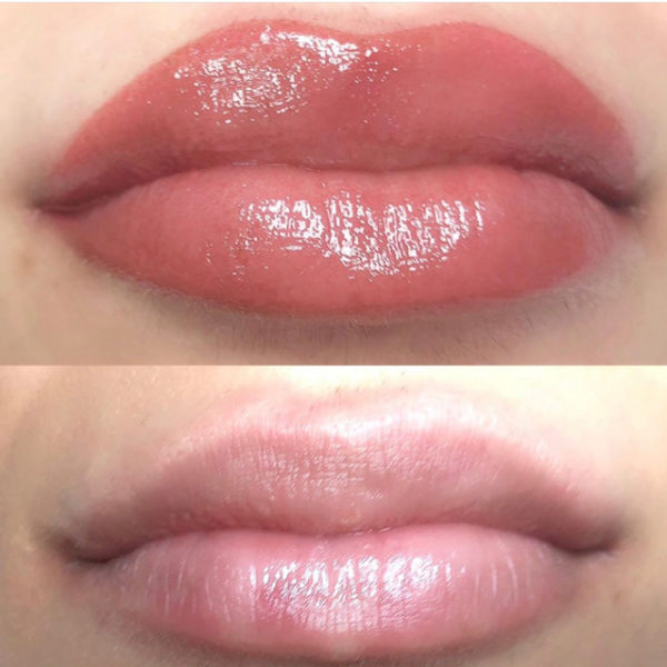 Before and after photos of a woman's lips.