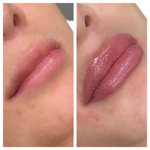 Before and after photos of a woman's lips.