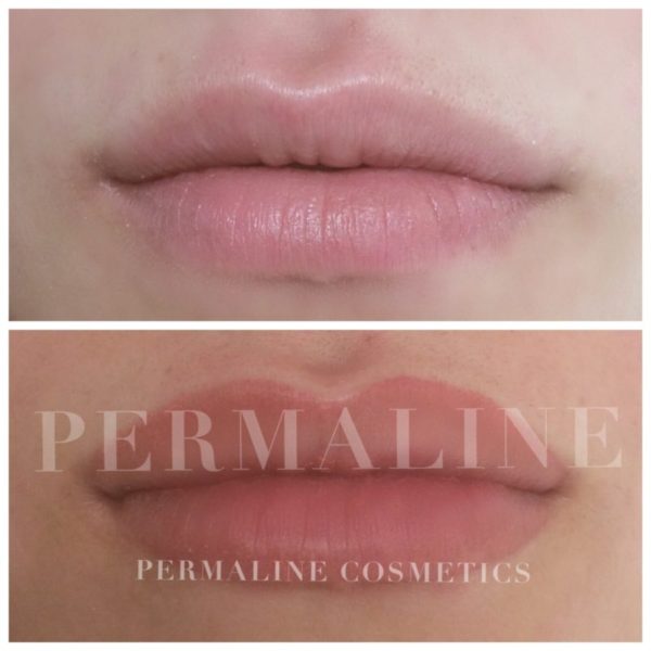 A before and after photo of a lip treatment by permaline cosmetics.