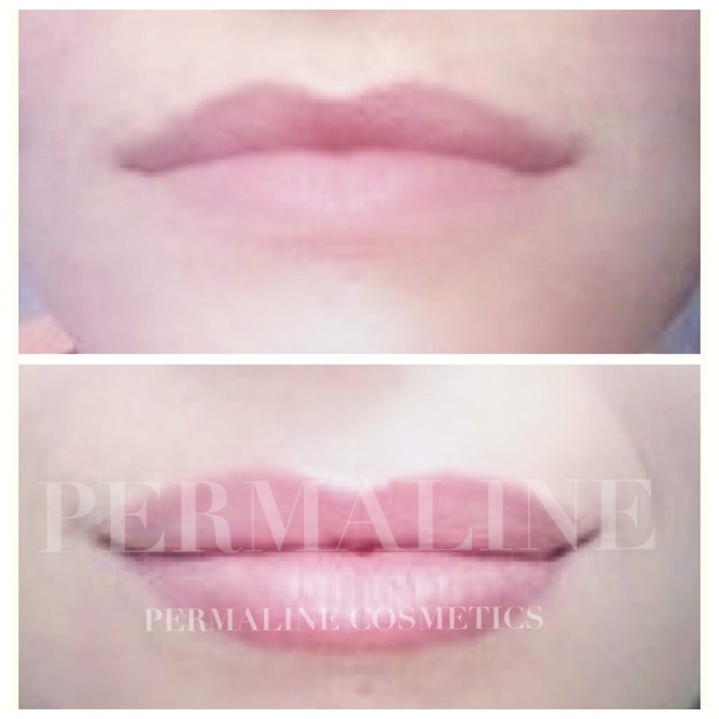 A before and after photo of a woman's lips.