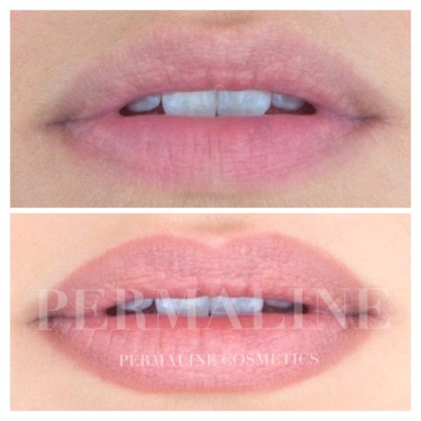 Before and after pictures of a woman's lips.