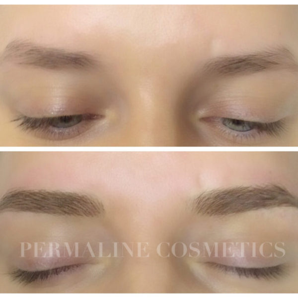 A woman's eyebrows before and after treatment.