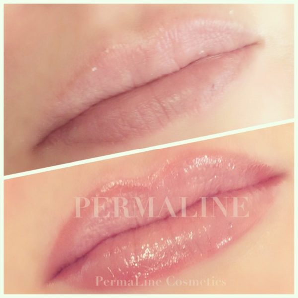 Two pictures of a woman's lips before and after a lip treatment.