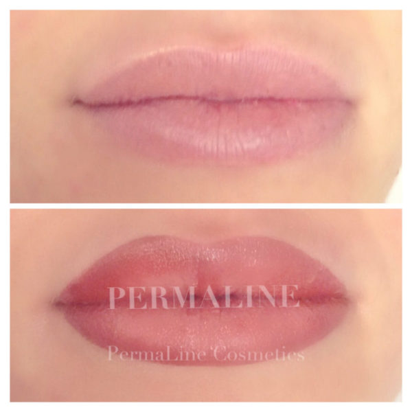 A before and after photo of a lip treatment.